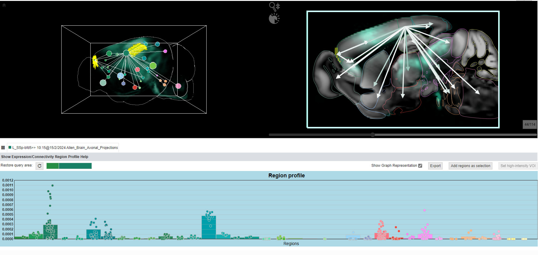 Screenshot aus der BrainTrawler-Software von VRVis.
